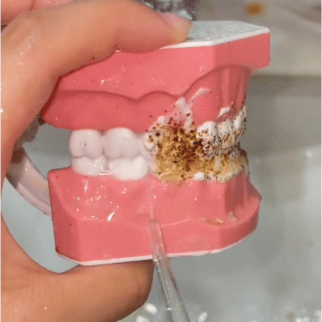 IRRIGADOR BUCAL PORTÁTIL