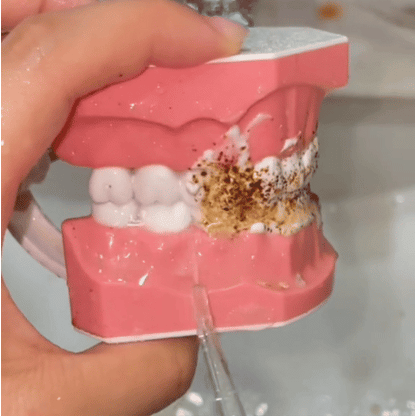 IRRIGADOR BUCAL PORTÁTIL